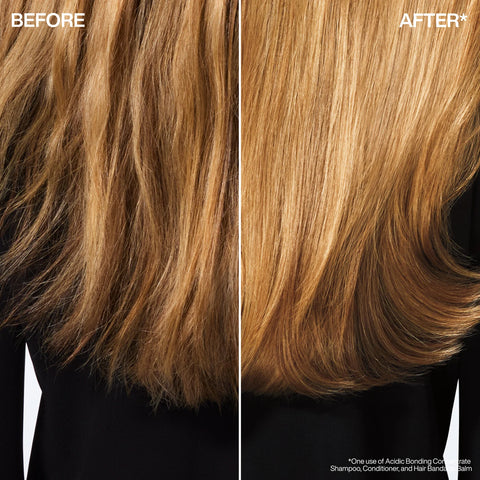 Acidic Bonding Concentrate Treatment Bundle